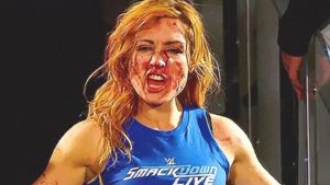 Becky Lynch