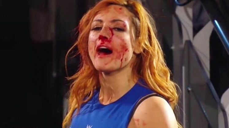 becky lynch bloody nose shirt